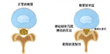 尿酸盐结晶最易堆积在什么部位?11月8日晚CDTV3《热线188》将邀请陈建春主任为你讲述! 尿酸盐结晶最易堆积在什么部位?11月8日晚CDTV3《热线188》将邀请陈建春主任为你讲述!