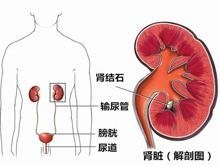 尿酸盐结晶最易堆积在什么部位?11月8日晚CDTV3《热线188》将邀请陈建春主任为你讲述! 尿酸盐结晶最易堆积在什么部位?11月8日晚CDTV3《热线188》将邀请陈建春主任为你讲述!