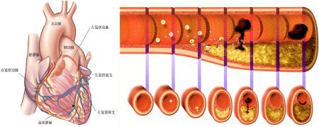尿酸盐结晶最易堆积在什么部位?11月8日晚CDTV3《热线188》将邀请陈建春主任为你讲述! 尿酸盐结晶最易堆积在什么部位?11月8日晚CDTV3《热线188》将邀请陈建春主任为你讲述!
