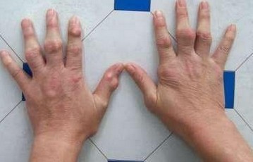 Ԥʹ缲ʹ综ճô.jpg