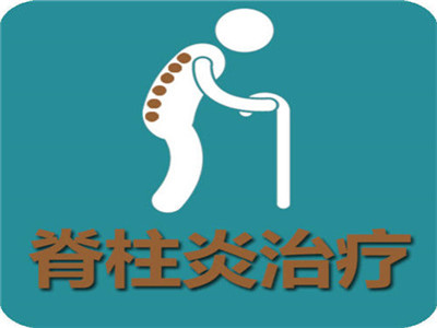 ǿֱԼעļ