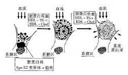 绵阳治痛风最专业医院